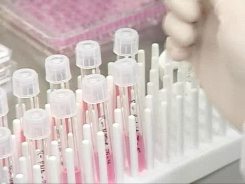 Из-за вируса H1N1 в Тбилиси закрыли школу